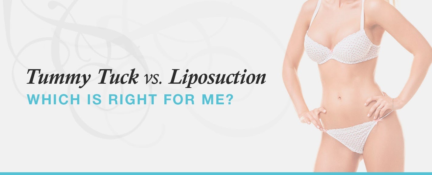 Liposuction Vs. CoolSculpting®: Which Is Best for Me?